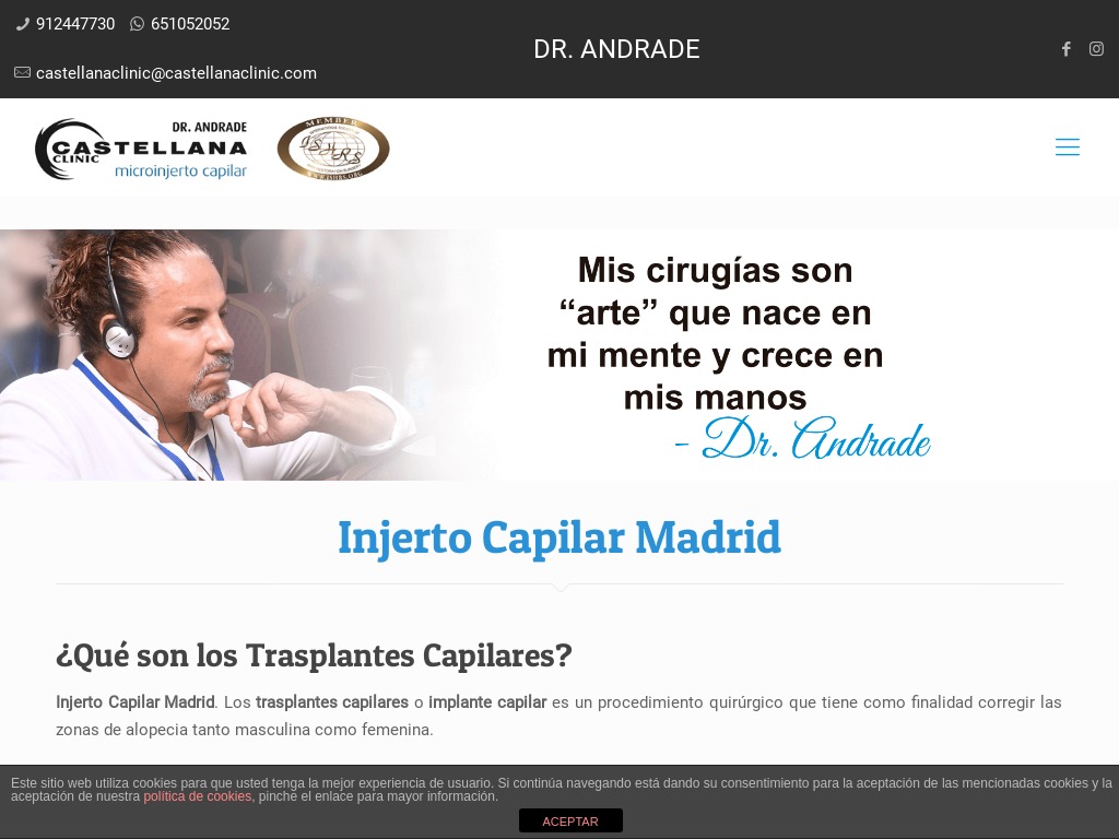 Trasplante Capilar Madrid