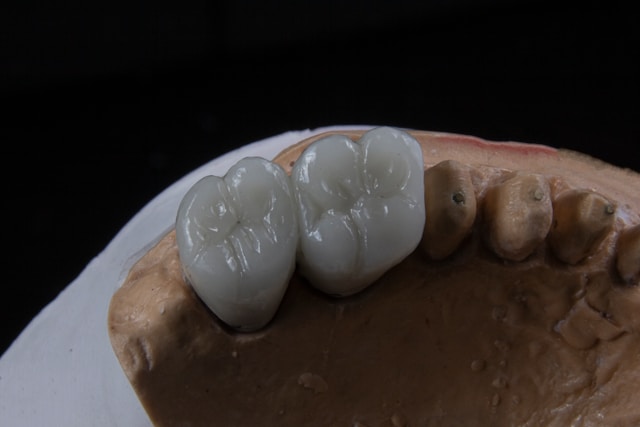 Implantes dentales de zirconio vs titanio: �cu�l elegir?